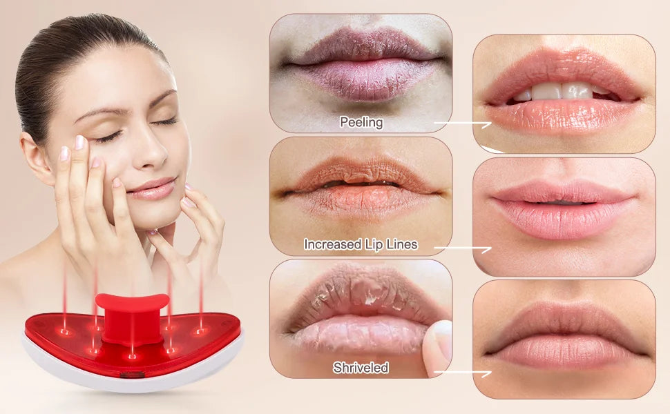 Lip Plumper and Eye Care Device